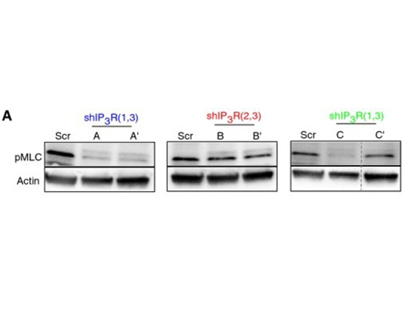 Western Blot using pMLC
